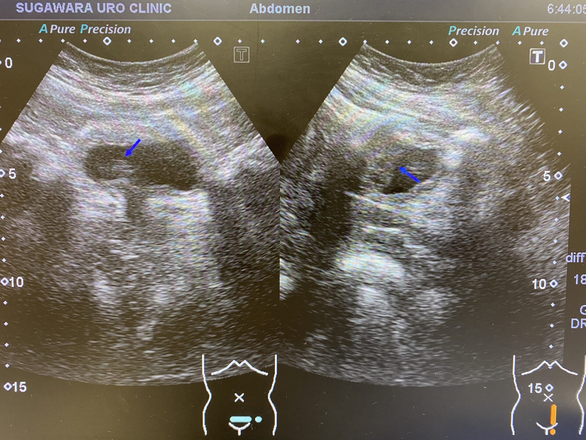 合併症が起こる可能性はありますか?