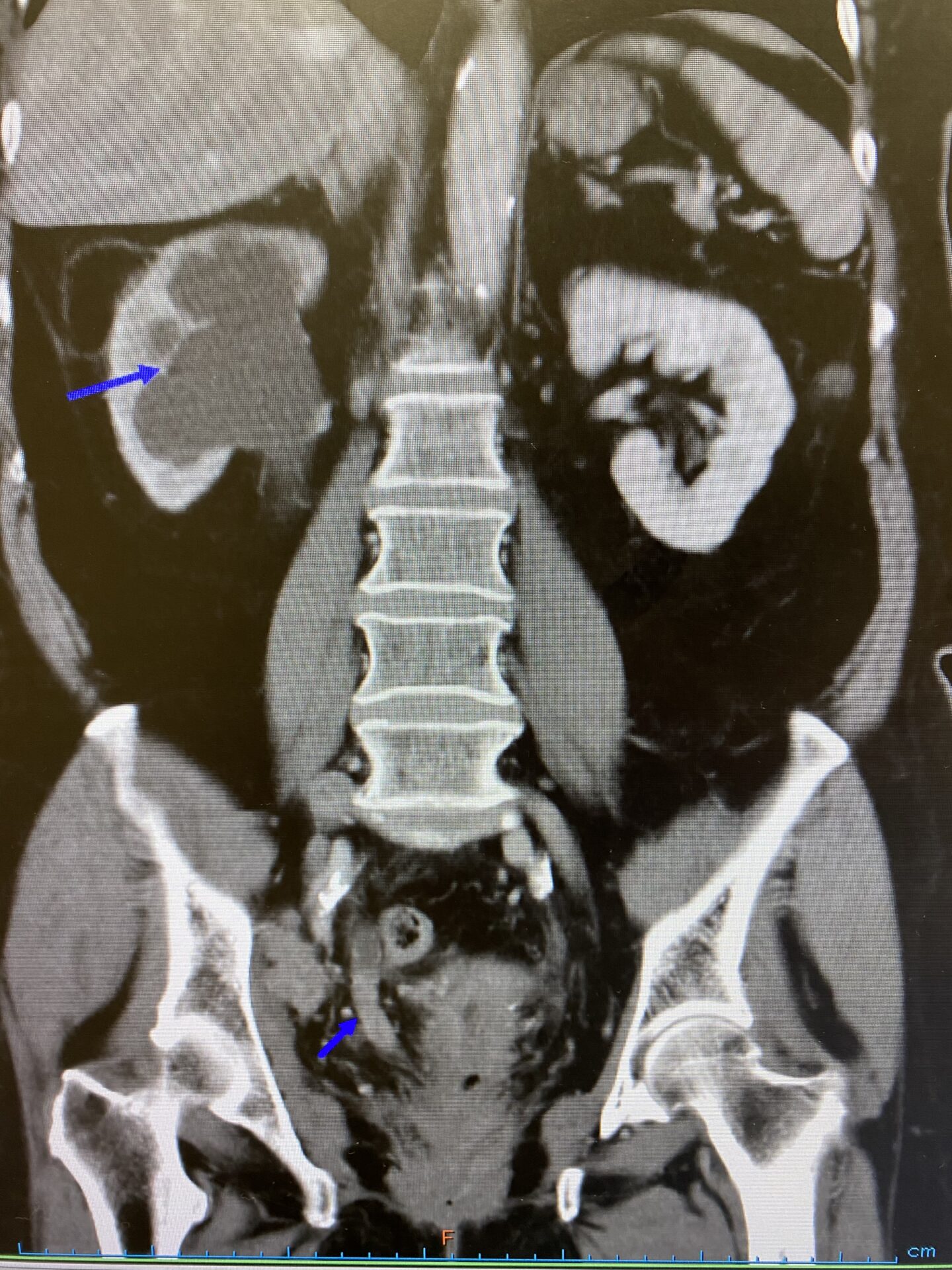 A11251292]Urology View 8ー4 特集:小径腎腫瘍の診断と治療
