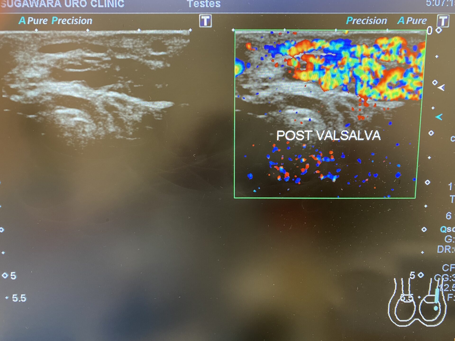 考えられる合併症