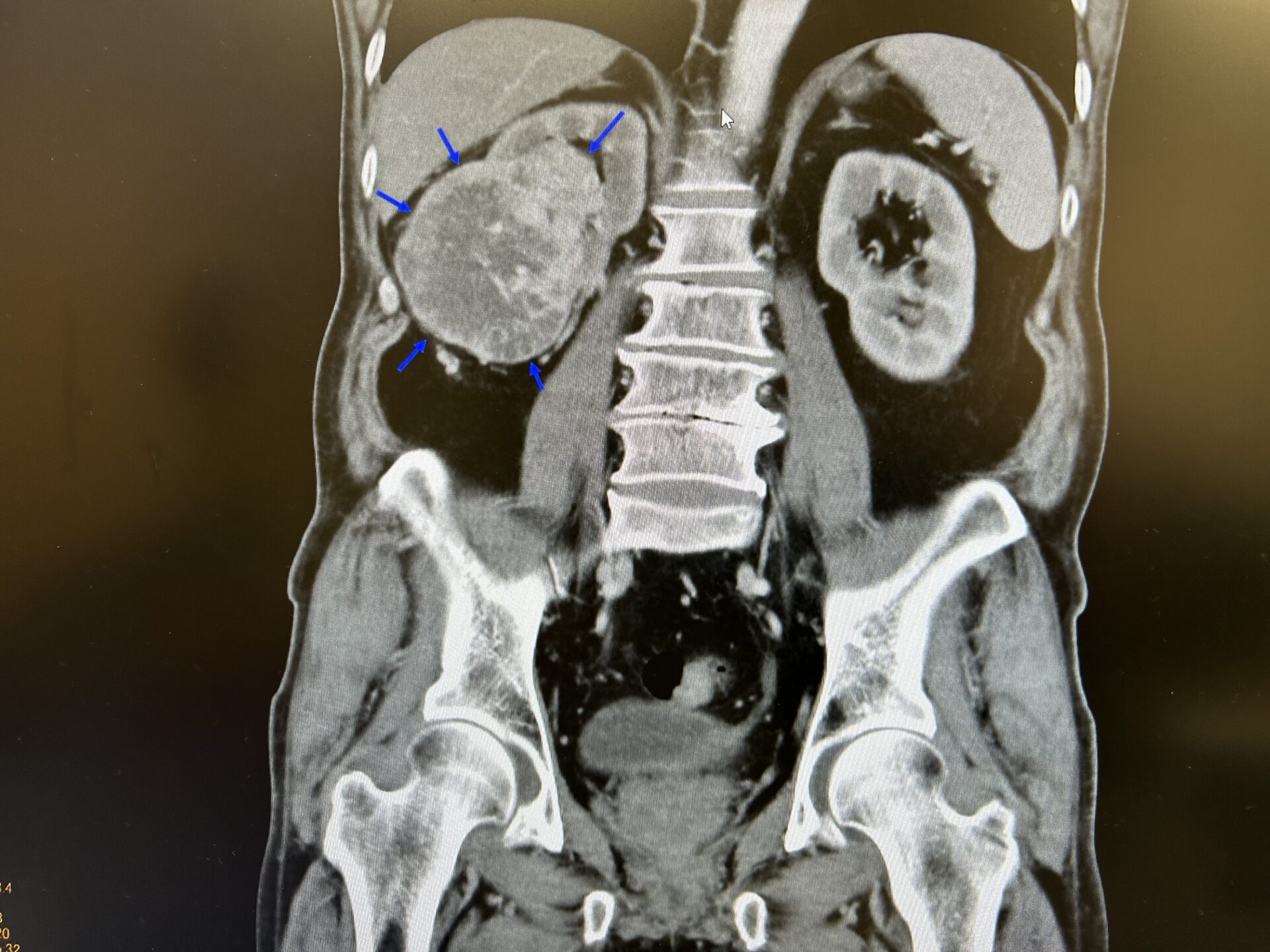 【楽天スーパーセール】 A11251292]Urology View 特集:小径腎腫瘍の診断と治療 8ー4 医学一般